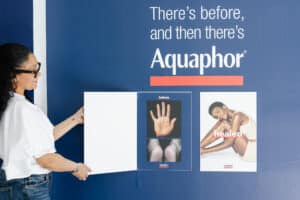 Aquaphor media event - before and after panel